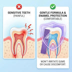 Purple Teeth Whitening Strips – Peroxide-Free & Sensitivity-Free Enamel Safe Dental Whitening Strips for Yellow Teeth
