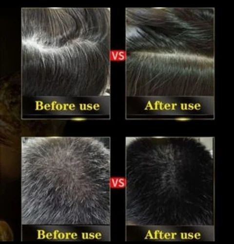 (Pack of 2) Black Hair Dye Shampoo 3-in-1 Hair Color Shampoo – Instant Grey Coverage Shampoo Based Hair Dye for Men & Women