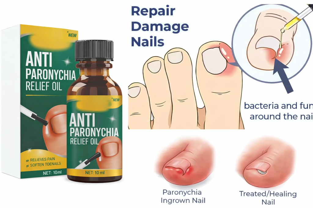 (Pack of 2) Anti Paronychia Relief Oil - Herbal Toenail Care Drops for Ingrown Nails, Cuticle Softening & Nail Bed Repair
